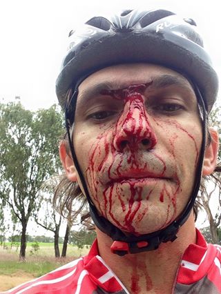 Mountain biker attacked and robbed in Blue Hills next to R562
