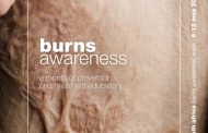 South Africa dedicates the month of May to Burns Awareness.