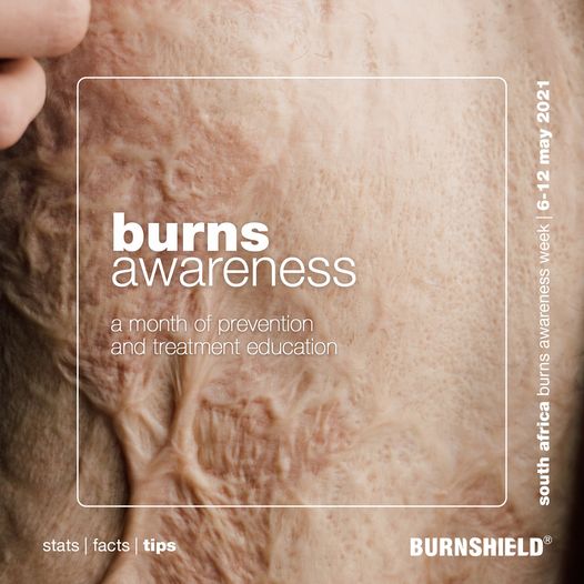 South Africa dedicates the month of May to Burns Awareness.