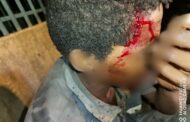 Destitute man shot while sleeping in Trenance Park