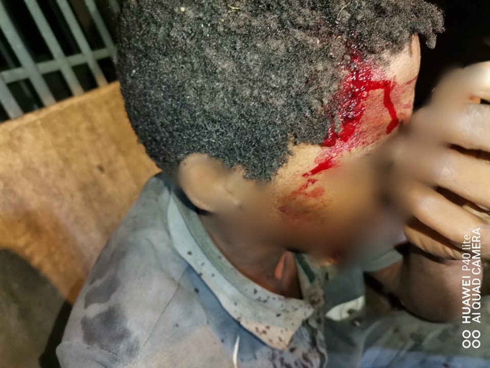 Destitute man shot while sleeping in Trenance Park