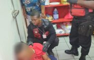 Fast food employee pistol-whipped during robbery in Phoenix