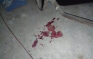 Victim shot during a robbery in Redcliffe