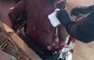 Burundian Nationals stabbed during robbery in Hazelmere