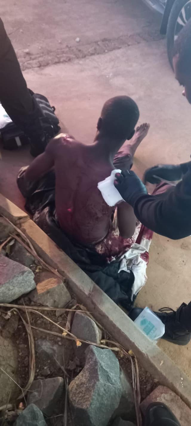 Burundian Nationals stabbed during robbery in Hazelmere