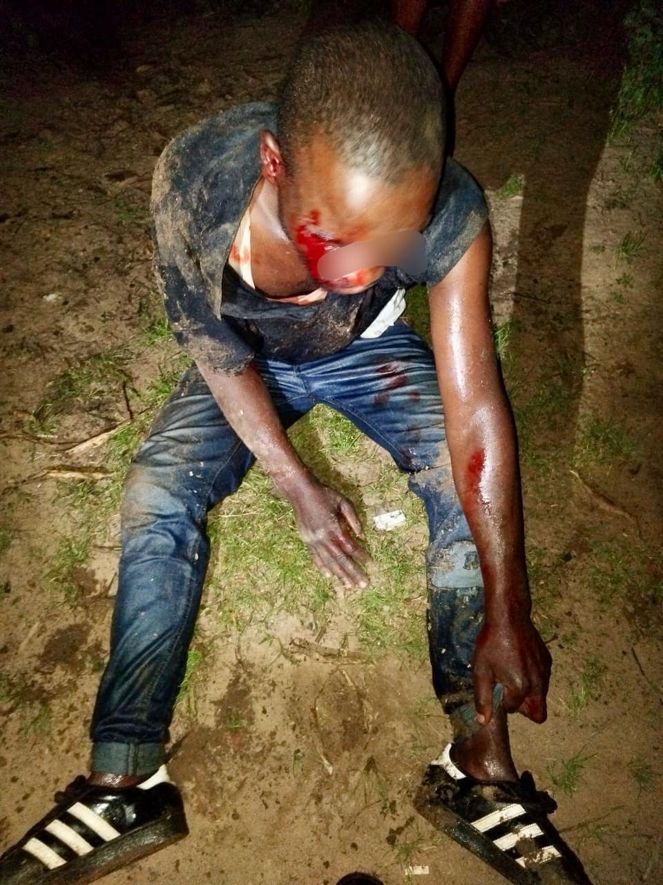 Theft suspect assaulted by churchgoers in Buffelsdraai