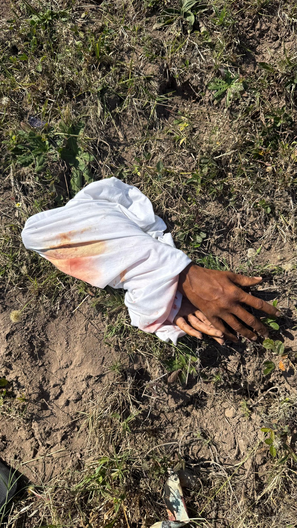 Medico Legal Mortuary Confirms Severed Hands Next to the Road To Be Props: Phoenix - KZN